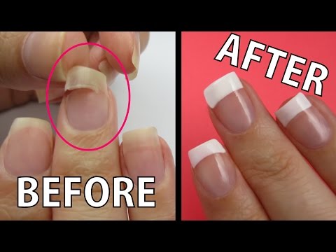 REPAIR A RIPPED NAIL FAST!