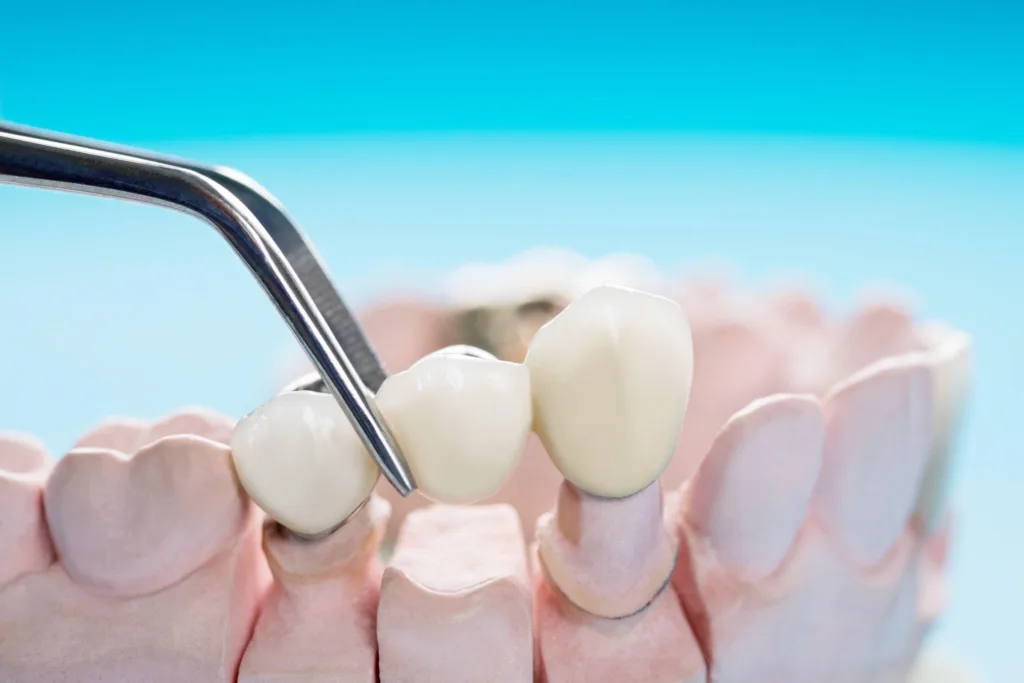 DentalGenesis.gr: Εξειδικευμένες Οδοντιατρικές Υπηρεσίες στην Καρδιά της Αθήνας