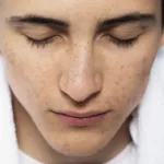 Πώς να μειώσεις τους πόρους στη μύτη και να καθαρίσεις το δέρμα σου με φυσικό τρόπο