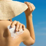 13 γρήγοροι τρόποι για να αντιμετωπίσεις το έγκαυμα από τον Ήλιο στο σπίτι