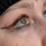 Πώς δημιουργούνται οι μαύροι κύκλοι κάτω από τα μάτια - Δεν είναι μόνο η κούραση