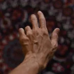 Γιατί οι φλέβες μας φαίνονται μπλε ενώ το αίμα είναι κόκκινο; Η αλήθεια σε 2 λεπτά