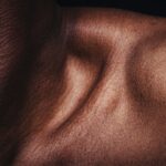 Πότε να μας ανησυχήσει μια ελιά στο δέρμα – Τα προειδοποιητικά σημάδια