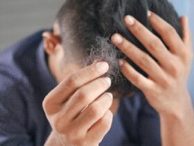 Τριχόπτωση: Η βιταμίνη που λείπει από τον οργανισμό σου και σώζει τα μαλλιά