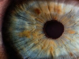 Μάτι που τρέμει: Γιατί συμβαίνει και πώς να το σταματήσετε