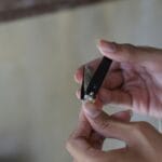 Μην τις τραβάτε ποτέ: Ο ασφαλής τρόπος να εξαφανίσετε τις παρανυχίδες χωρίς μόλυνση